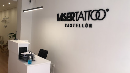 Laser Tattoo Castellón