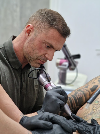 Laser Tattoo Valencia- Expertos En Eliminación De Tatuajes
