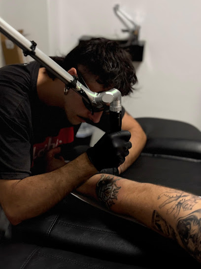 Nuevo Lienzo – Eliminación De Tatuajes