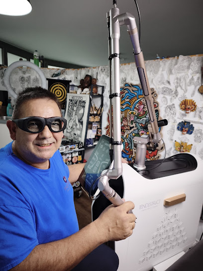 Tendistrict – Eliminación De Tatuajes